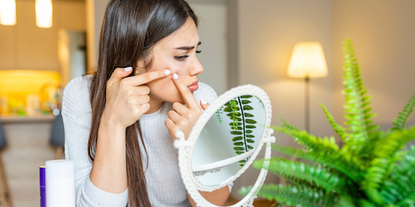 Natuurlijke wondermiddelen tegen puistjes