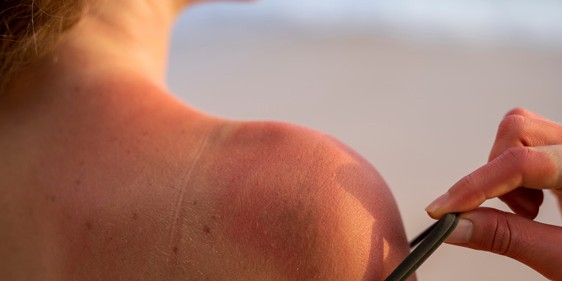 Vrouwen met lang haar proberen een kale kop voor een dag